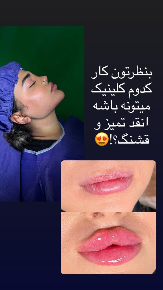  جدید ترین استوری اینستاگرام فاطمه مکاری