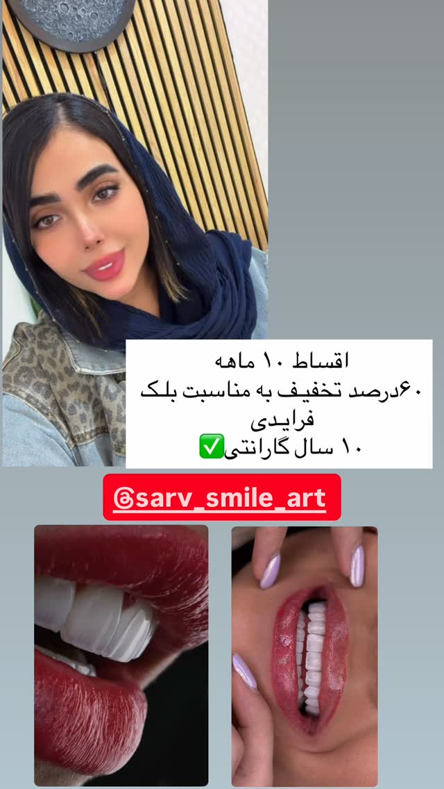  جدید ترین استوری اینستاگرام فاطمه مکاری