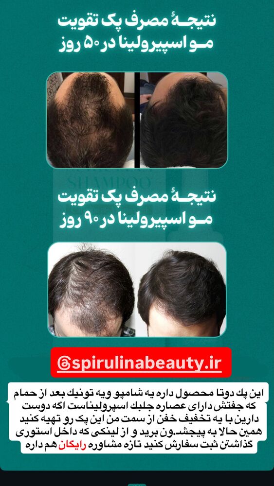  جدید ترین استوری اینستاگرام فاطمه مکاری