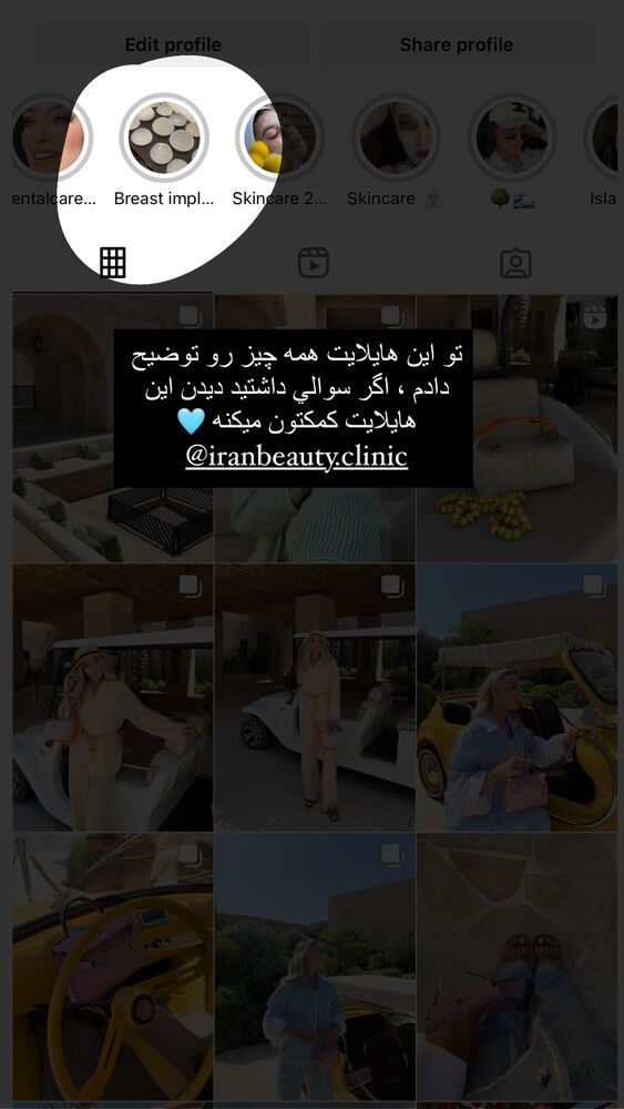  جدید ترین استوری اینستاگرام فوژان
