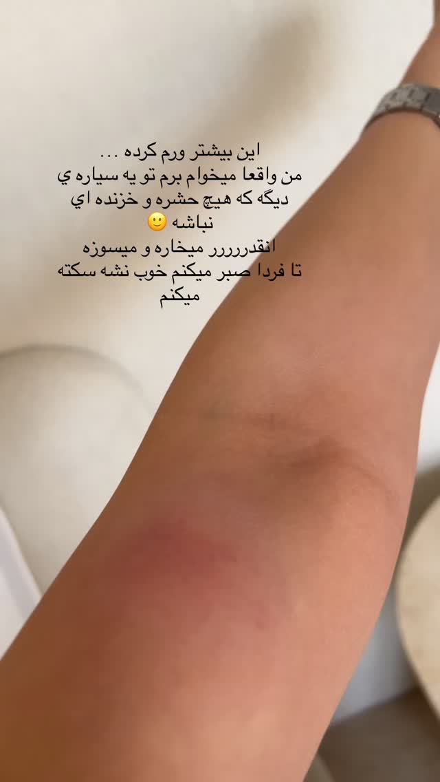  جدید ترین استوری اینستاگرام فوژان