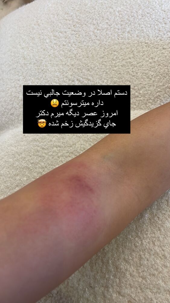  جدید ترین استوری اینستاگرام فوژان