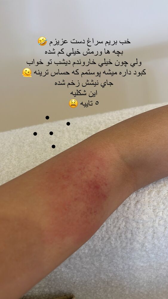  جدید ترین استوری اینستاگرام فوژان