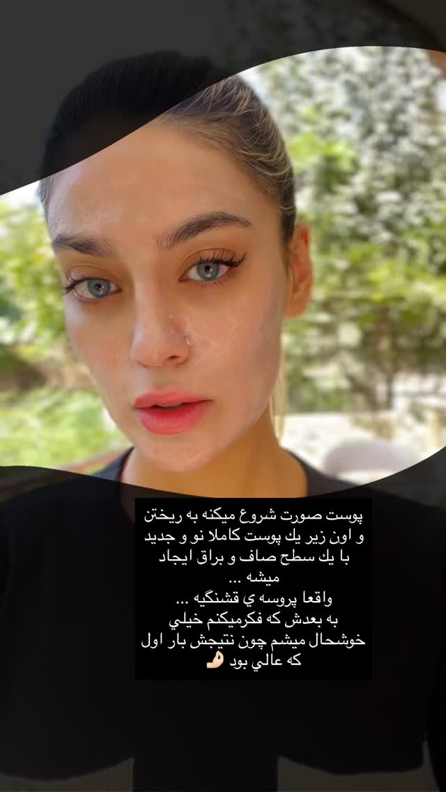  جدید ترین استوری اینستاگرام فوژان
