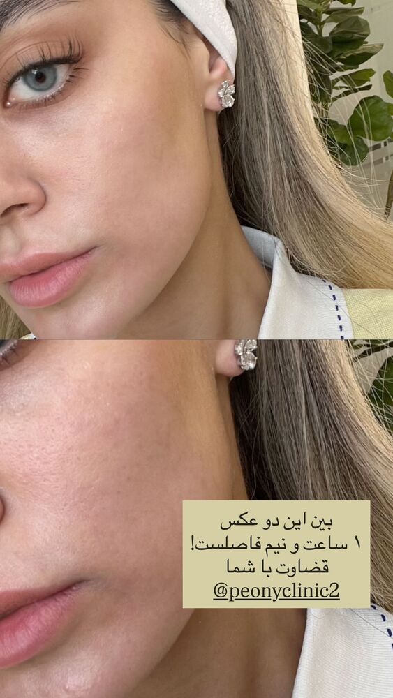  جدید ترین استوری اینستاگرام فوژان