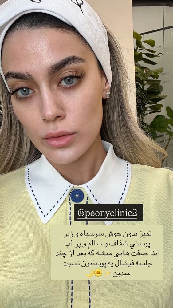 جدید ترین استوری اینستاگرام فوژان