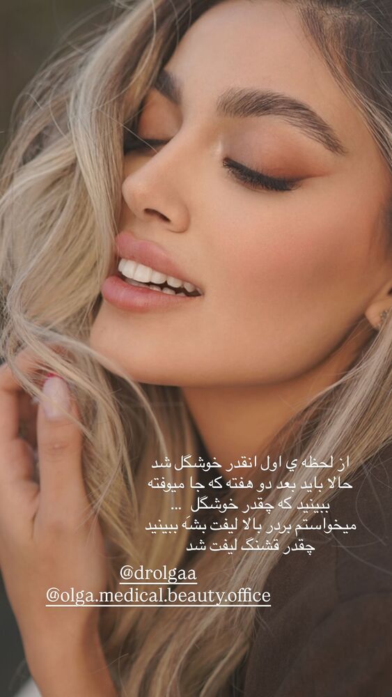  جدید ترین استوری اینستاگرام فوژان