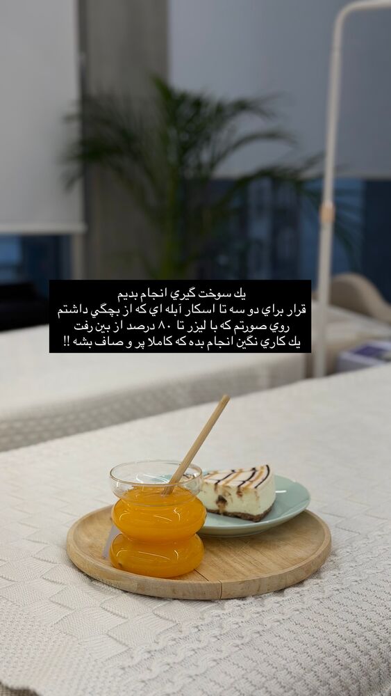  جدید ترین استوری اینستاگرام فوژان