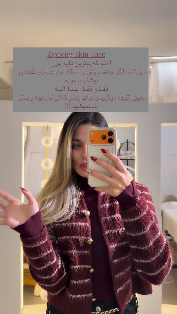  جدید ترین استوری اینستاگرام فوژان