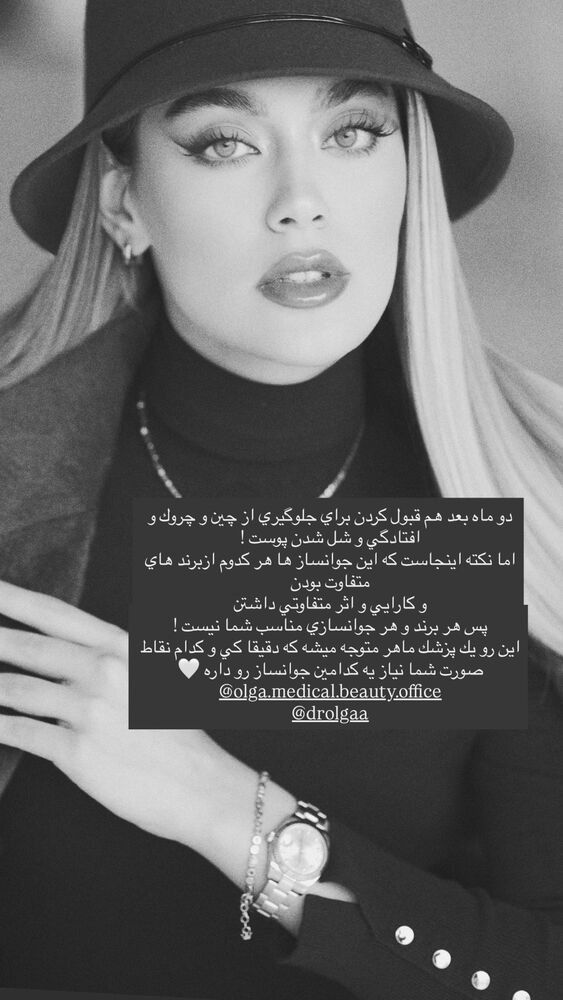  جدید ترین استوری اینستاگرام فوژان