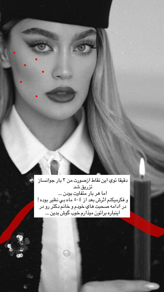  جدید ترین استوری اینستاگرام فوژان