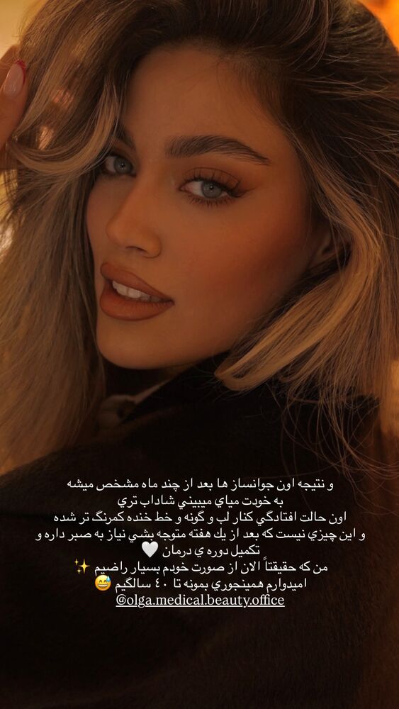  جدید ترین استوری اینستاگرام فوژان