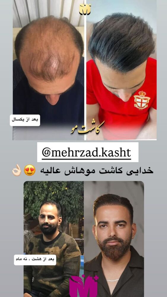  جدید ترین استوری اینستاگرام گندم گیلک