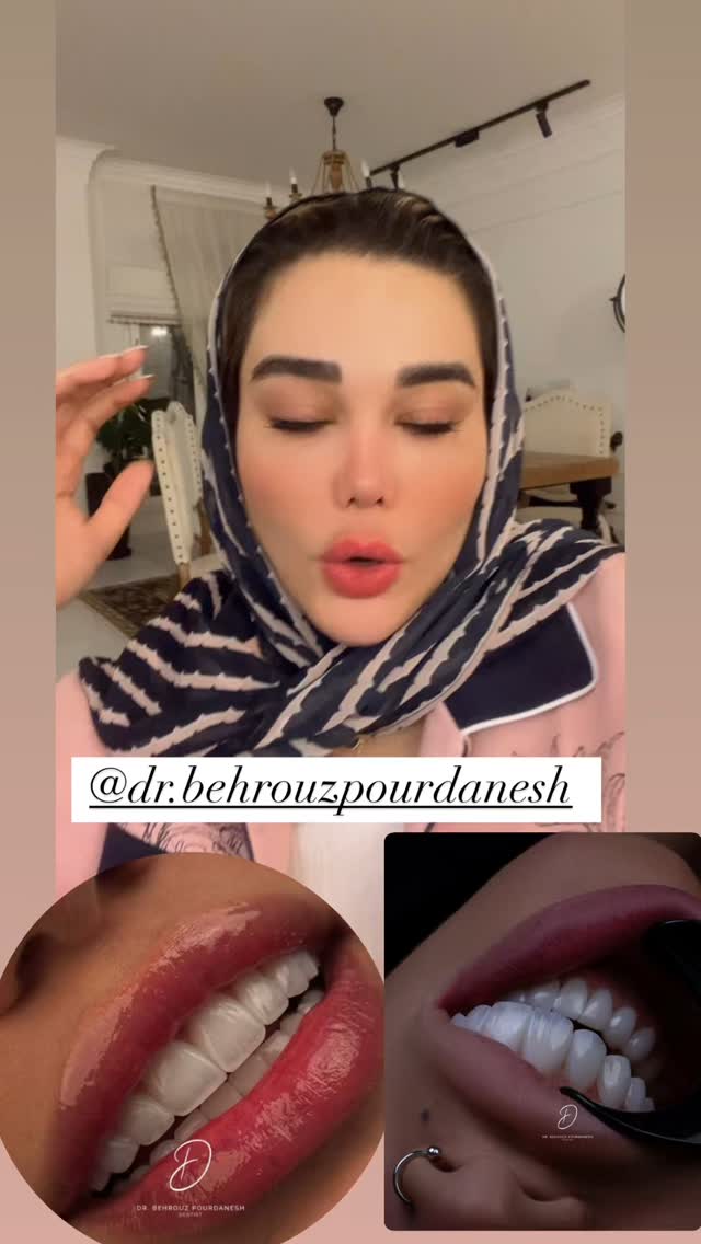  جدید ترین استوری اینستاگرام گندم گیلک