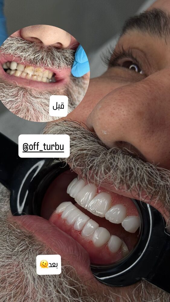  جدید ترین استوری اینستاگرام گندم گیلک