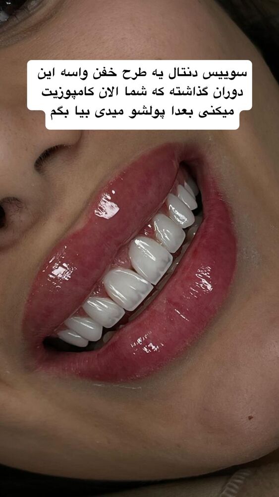 جدید ترین استوری اینستاگرام گندم گیلک