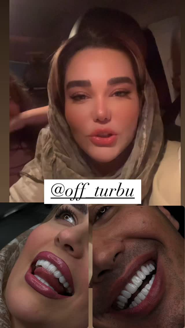  جدید ترین استوری اینستاگرام گندم گیلک