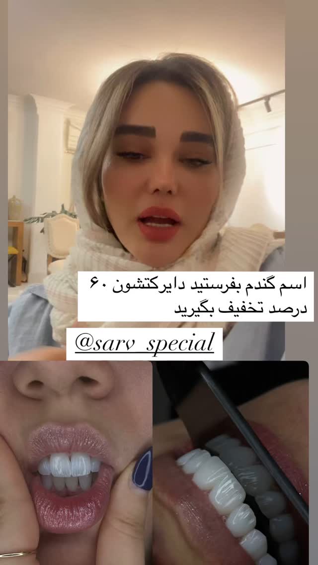  جدید ترین استوری اینستاگرام گندم گیلک