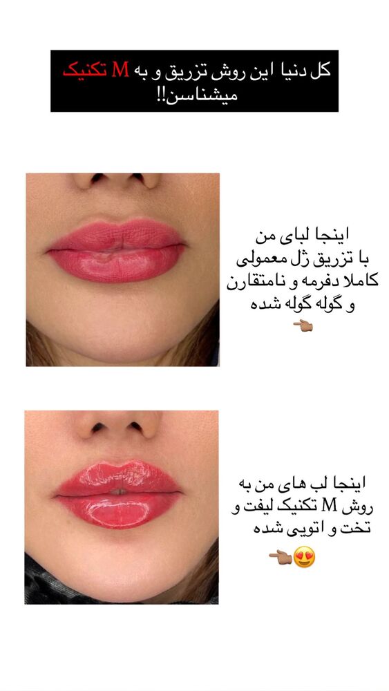  جدید ترین استوری اینستاگرام گندم گیلک