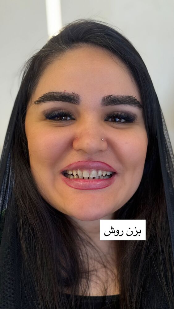  جدید ترین استوری اینستاگرام گندم گیلک
