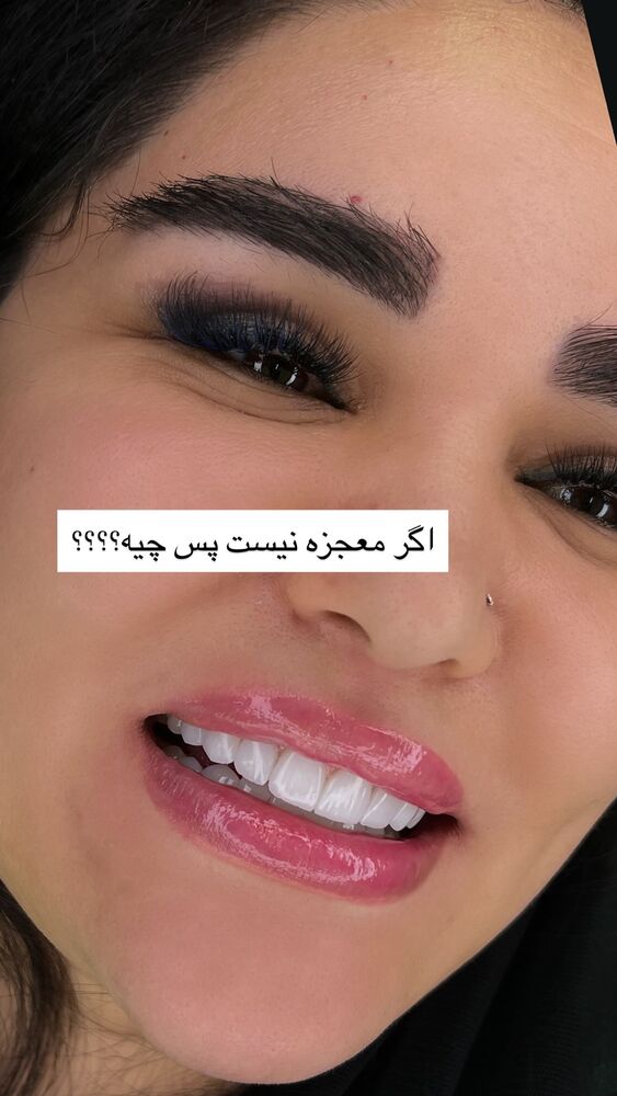  جدید ترین استوری اینستاگرام گندم گیلک
