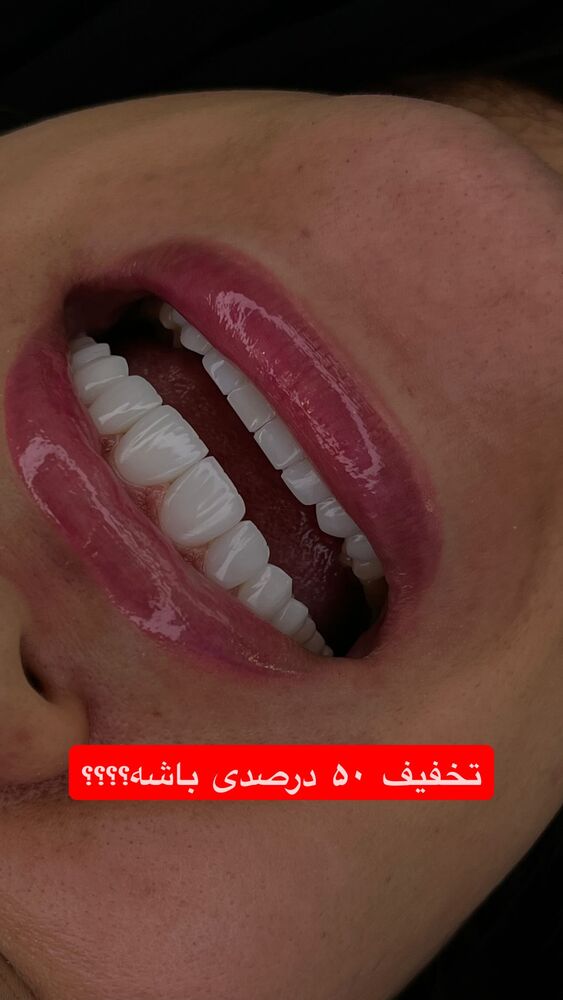  جدید ترین استوری اینستاگرام گندم گیلک