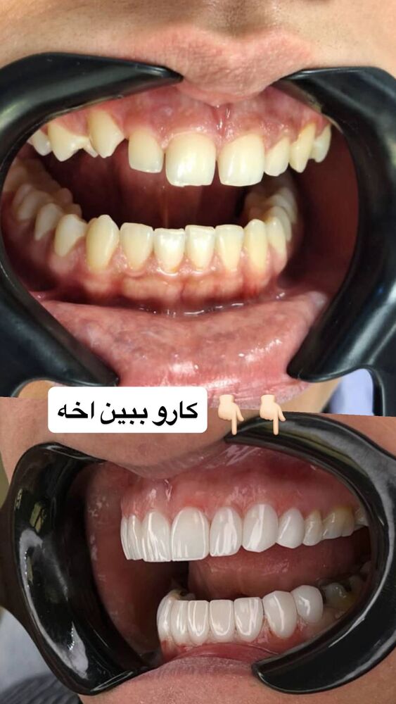  جدید ترین استوری اینستاگرام گندم گیلک