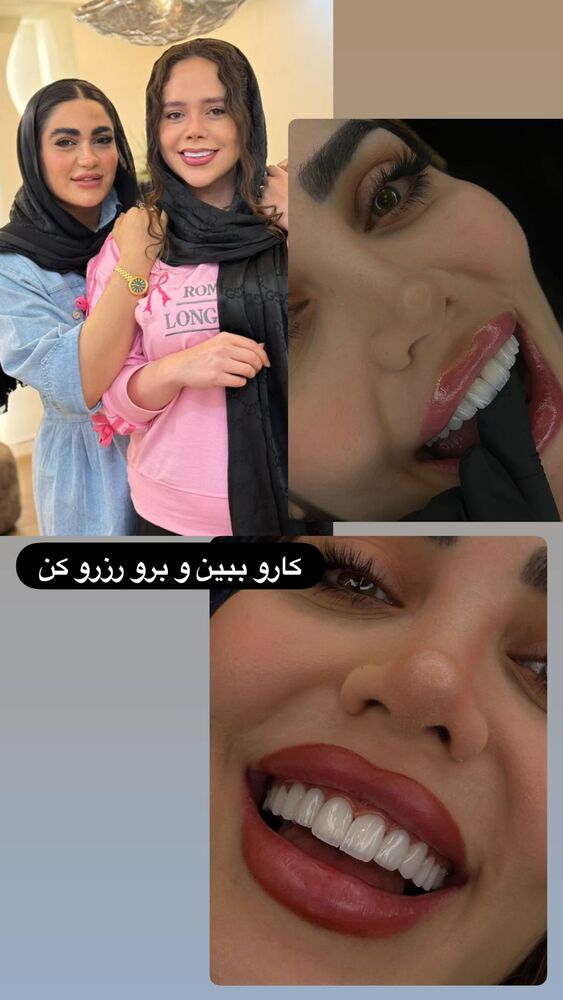  جدید ترین استوری اینستاگرام گندم گیلک