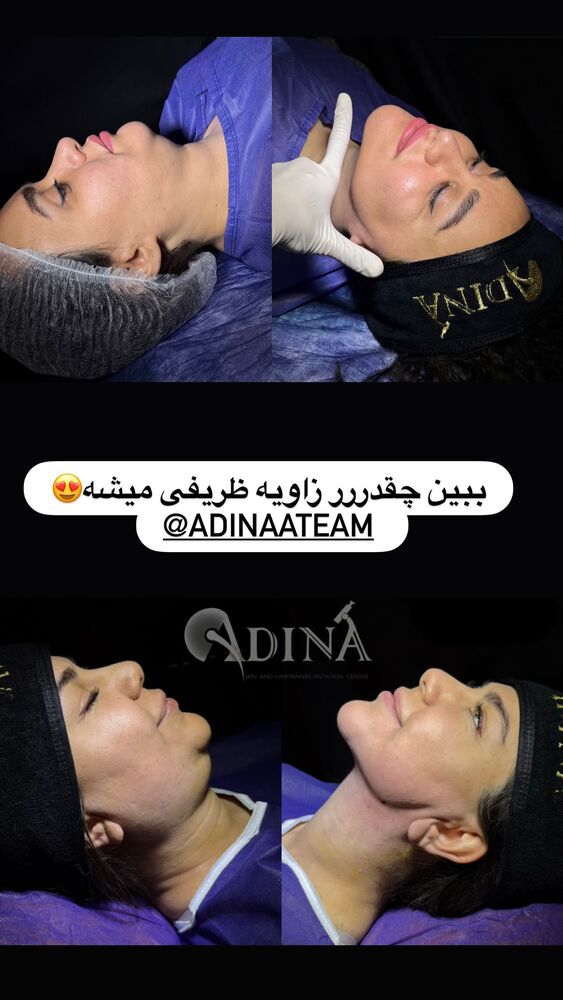  جدید ترین استوری اینستاگرام گندم گیلک