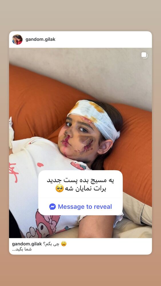  جدید ترین استوری اینستاگرام گندم گیلک