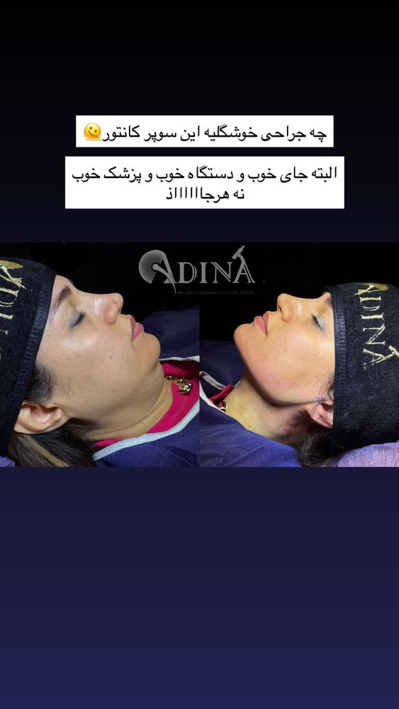  جدید ترین استوری اینستاگرام گندم گیلک