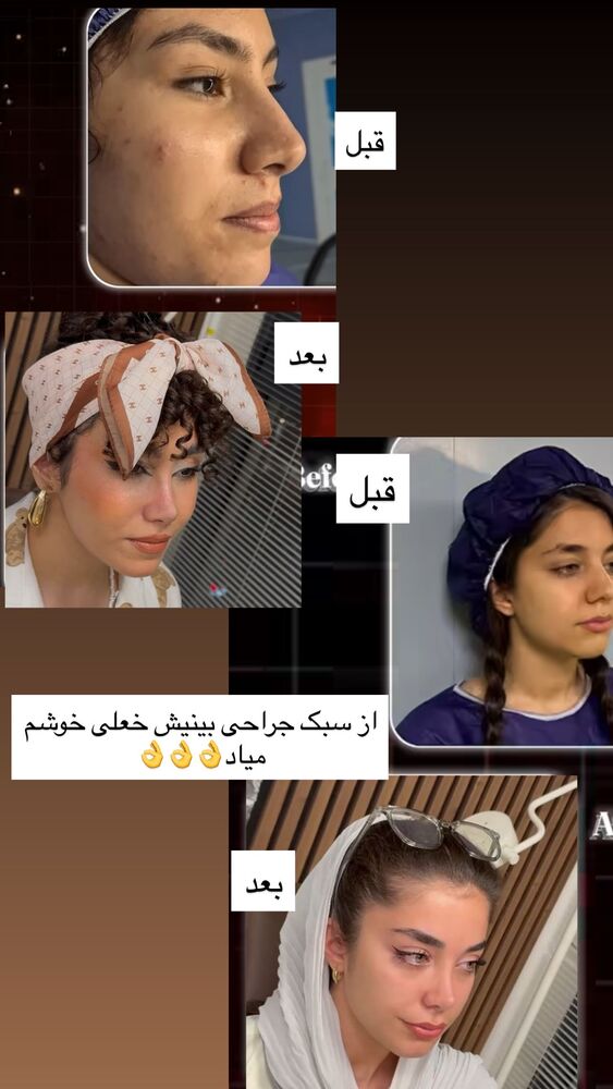  جدید ترین استوری اینستاگرام گندم گیلک