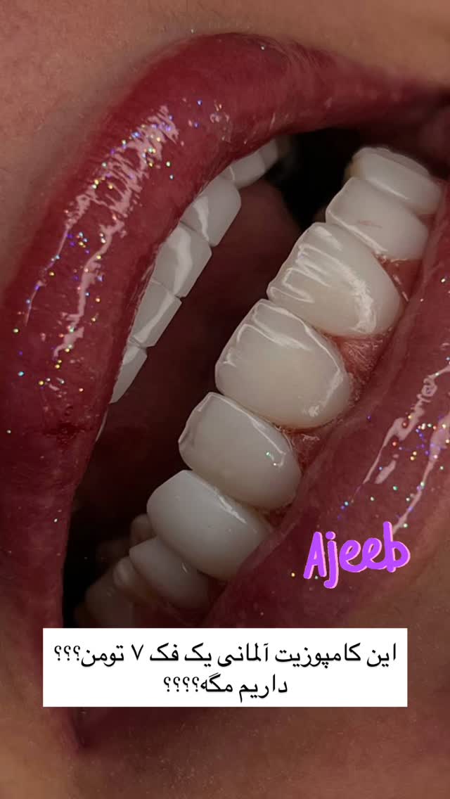  جدید ترین استوری اینستاگرام گندم گیلک