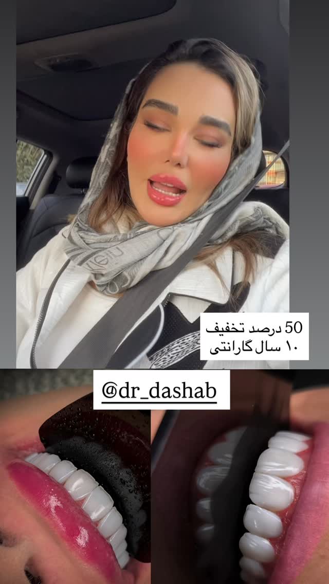  جدید ترین استوری اینستاگرام گندم گیلک