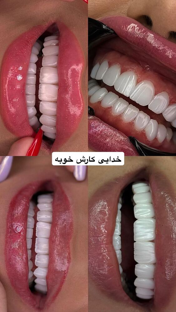  جدید ترین استوری اینستاگرام گندم گیلک