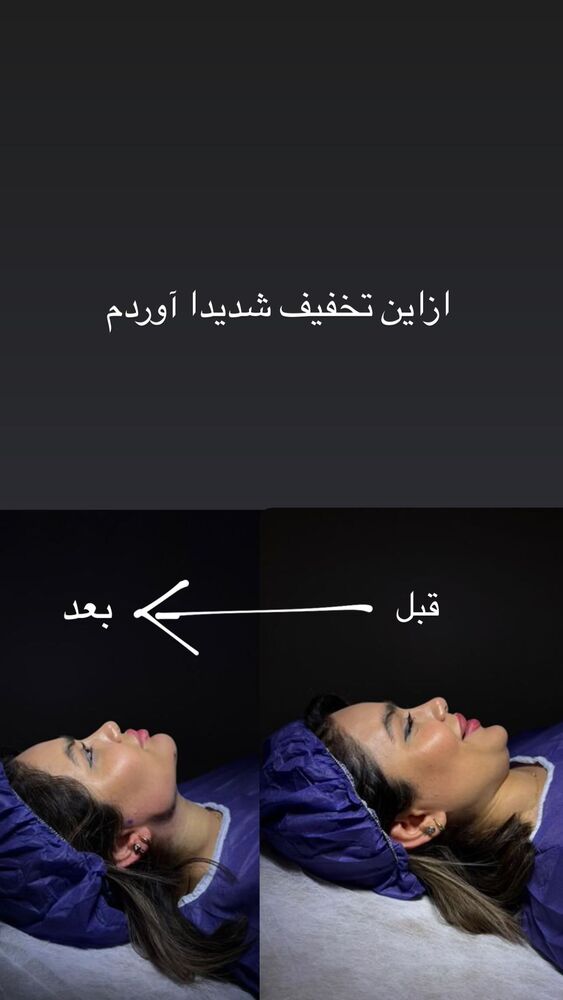  جدید ترین استوری اینستاگرام گندم گیلک