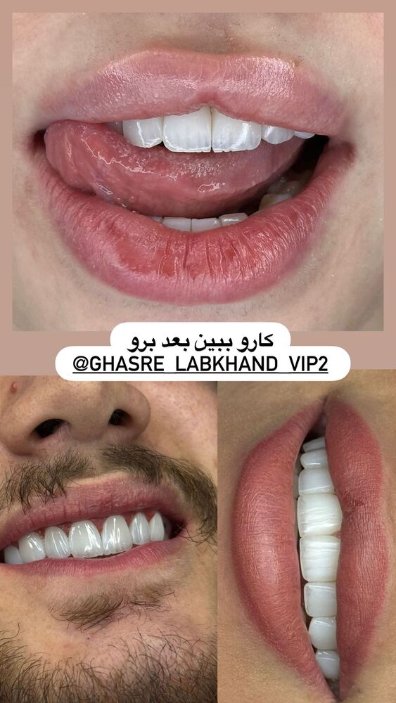  جدید ترین استوری اینستاگرام گندم گیلک