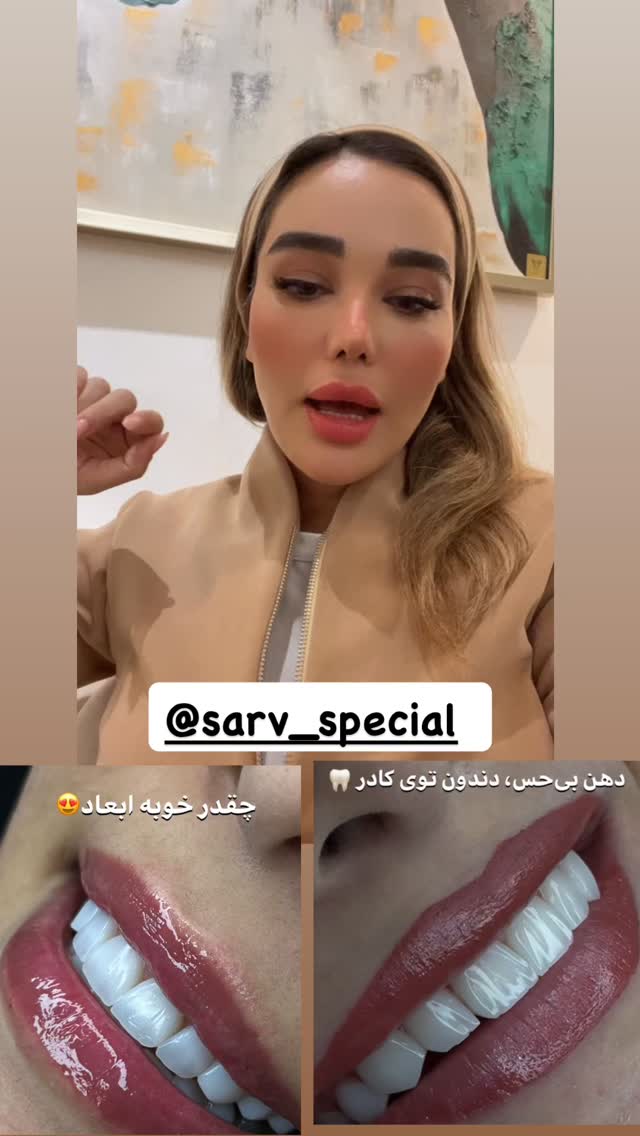  جدید ترین استوری اینستاگرام گندم گیلک