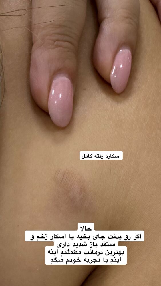  جدید ترین استوری اینستاگرام گندم گیلک