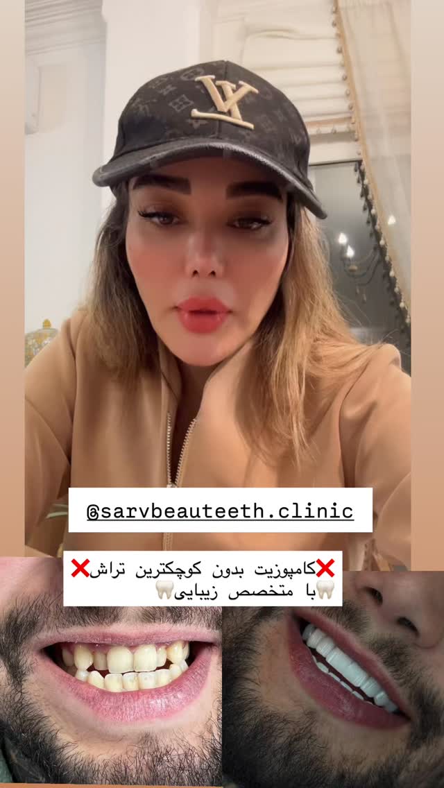  جدید ترین استوری اینستاگرام گندم گیلک