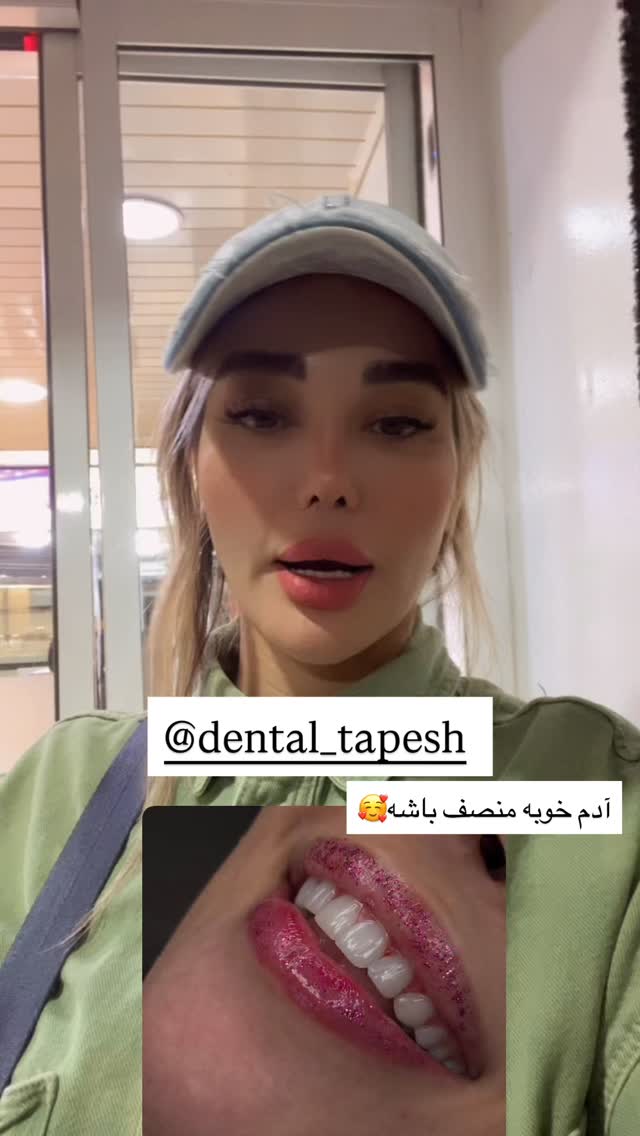  جدید ترین استوری اینستاگرام گندم گیلک