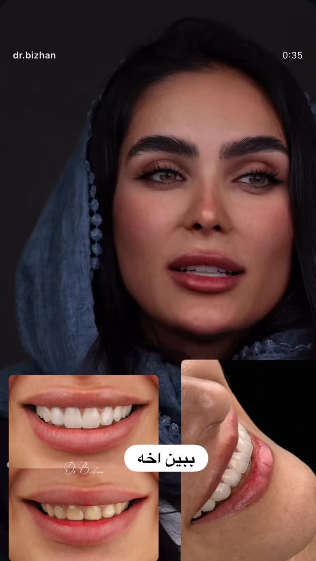  جدید ترین استوری اینستاگرام گندم گیلک