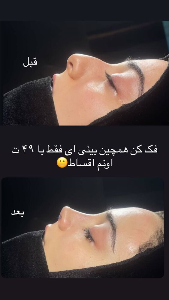  جدید ترین استوری اینستاگرام گندم گیلک