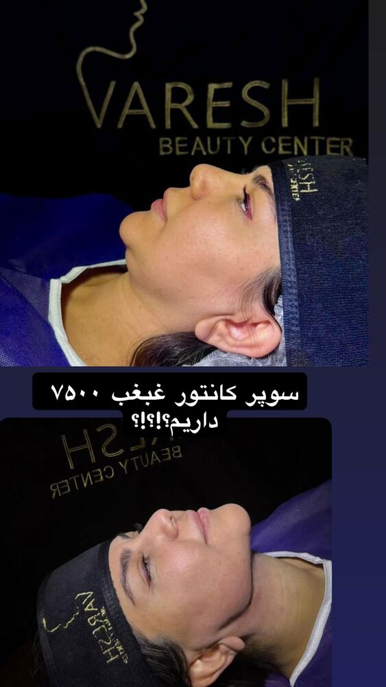  جدید ترین استوری اینستاگرام گندم گیلک