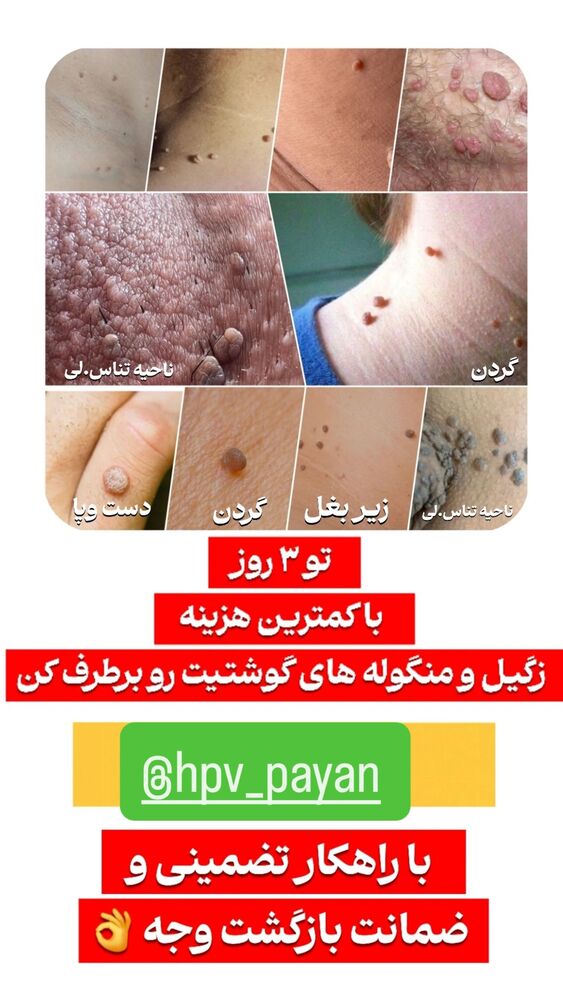  جدید ترین استوری اینستاگرام علی رضا گالش
