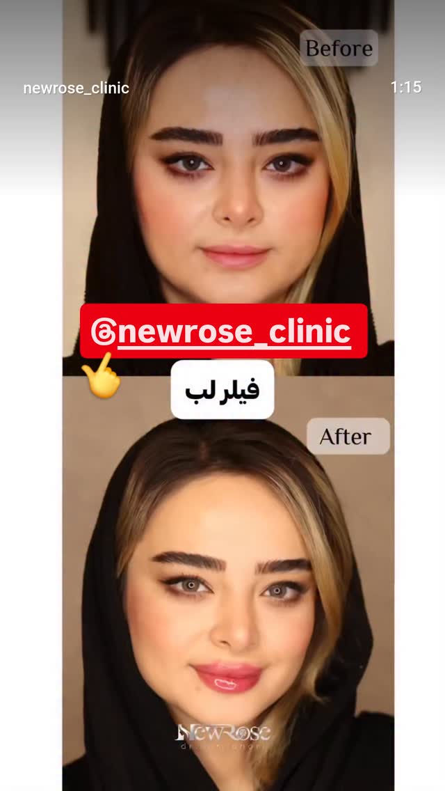  جدید ترین استوری اینستاگرام احسان محبتی