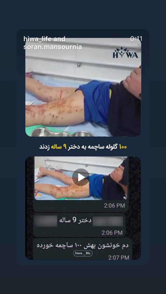  جدید ترین استوری اینستاگرام گيلدا ويشكى