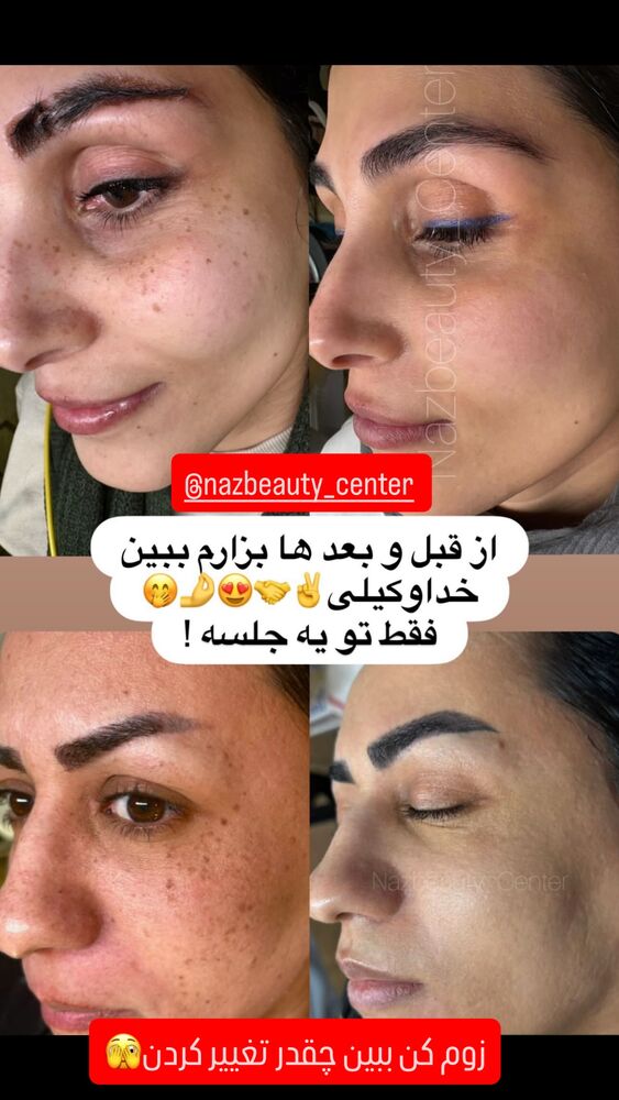  جدید ترین استوری اینستاگرام گیتا اخوان