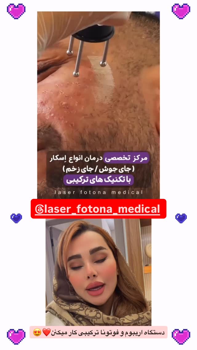  جدید ترین استوری اینستاگرام گیتا اخوان