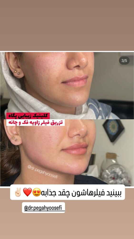  جدید ترین استوری اینستاگرام گیتا اخوان